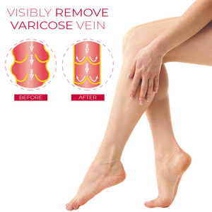 VeinHeal VaricoseSpider Rose MassageOil