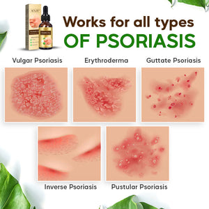 AEXZR Psoriasis Cure Essential Oil